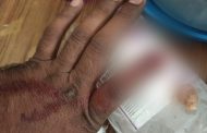 रिक्षाचालकाने चक्क पोलिसाच्या अंगठ्याचा चावा घेत बोटच तोडले...
